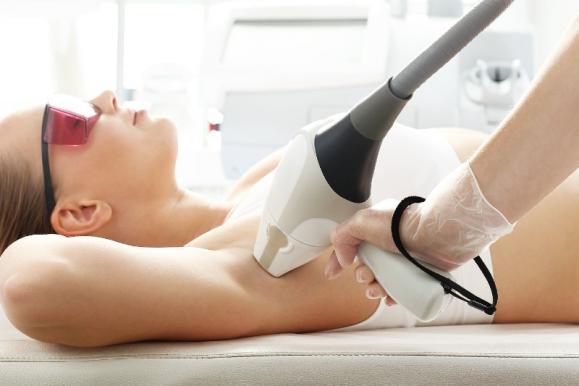 épilation laser épilation laser